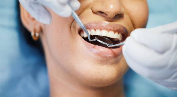 Best Pediatric Emergency Dentist in West Linn, OR